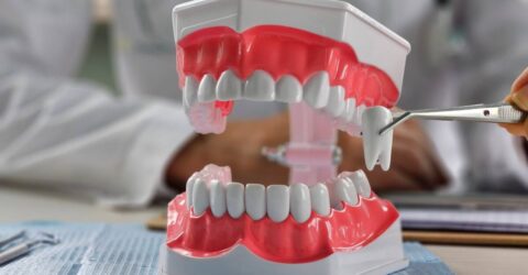 Aparat dentar cu extracție? Peste 52% dintre medici aleg această soluție