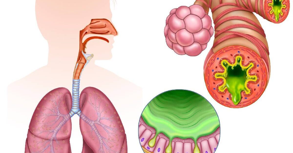 Inflamația cronică dușmanul tăcut care stă la baza bolilor moderne