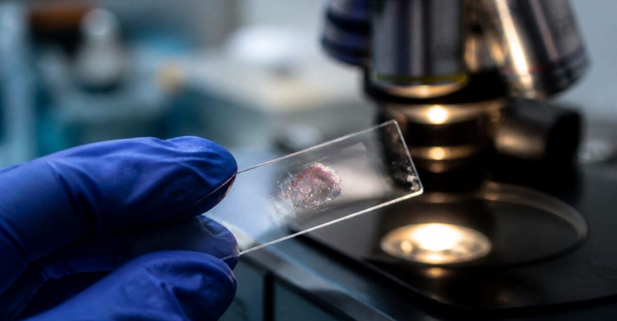 METTL3, proteina care ajută cancerul mamar să se răspândească. Ce au descoperit cercetătorii de la Umeå