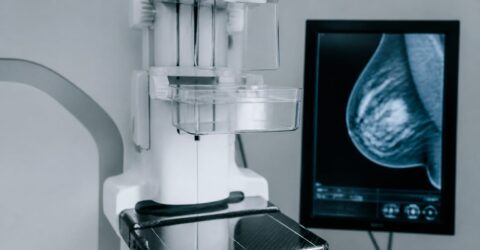 Cancerul este diagnosticat mai des, dar se moare mai rar din cauza lui. Ce înseamnă pentru tine scăderea mortalității