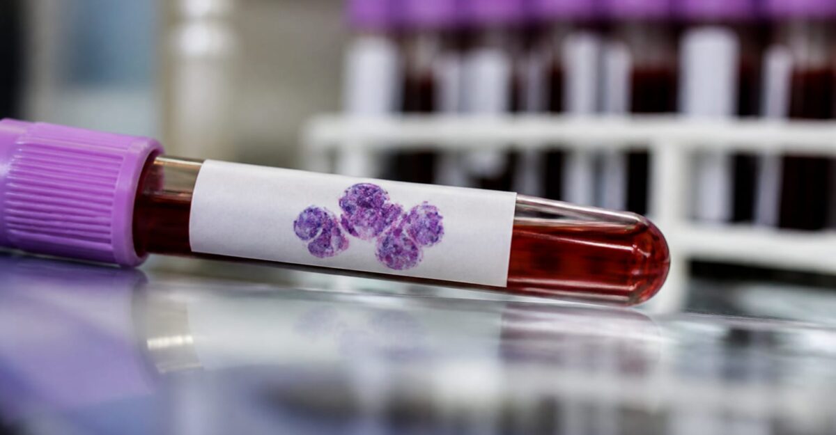 Un gust metalic persistent în gură a dus la un diagnostic de mielom. Când e cazul să mergi la medic