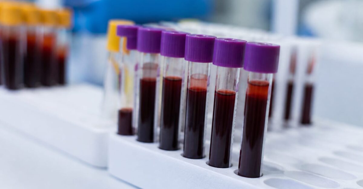 Același test de sânge pentru Alzheimer ar putea fi citit diferit la femei și bărbați