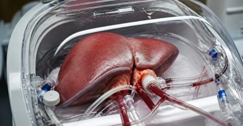 O nouă metodă de conservare a organelor aduce încă 150 de transplanturi de ficat pe an
