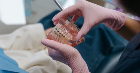 Aparat dentar sau implanturi? Cum alegi tratamentul potrivit, explicat de specialiștii Upgrade Dental