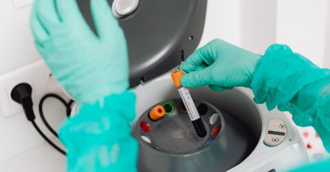 România are peste 60% diagnostice HIV tardive, printre cele mai ridicate proporții din UE
