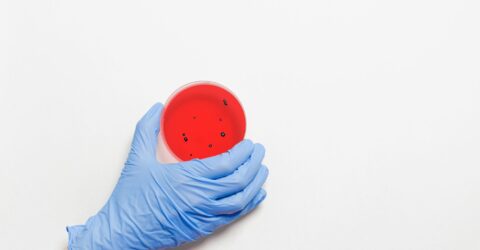 Durerile digestive pot continua ani după o toxiinfecție alimentară. Ce este colonul iritabil post-infecțios