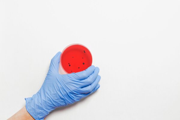 Durerile digestive pot continua ani după o toxiinfecție alimentară. Ce este colonul iritabil post-infecțios