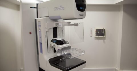 Când faci mamografia între 50 și 69 de ani și ce schimbări ale sânului au nevoie de un consult medical