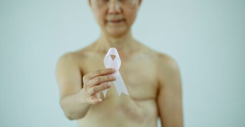 Când ai nevoie de mamografie după 40 de ani, chiar dacă rezultatul ecografiei mamare este bun