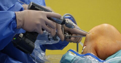 Studiul nu găsește rezultate mai bune după proteza de genunchi cu robot față de metoda clasică