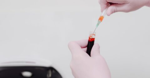 Sifilisul poate ajunge la copil în sarcină. Testarea este recomandată la luarea în evidență